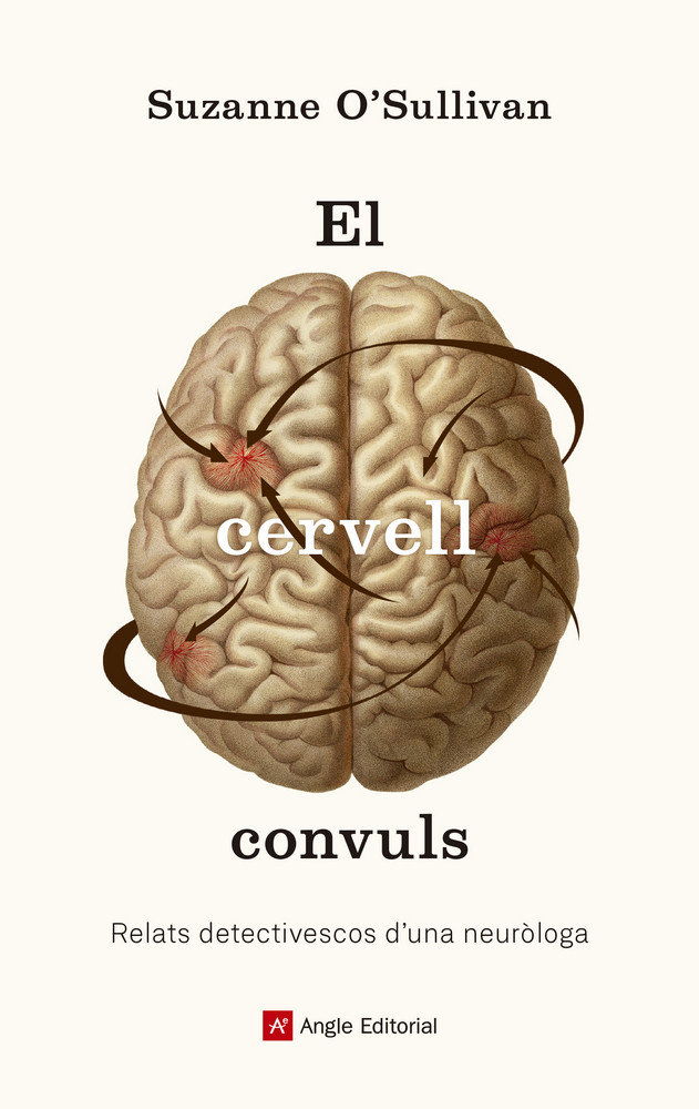 Cervell Convuls el-O'sullivan Suzanne